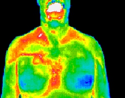 Thermal Image Breast Male