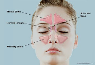 Sinus Areas