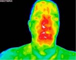 Thermal Image Sinus